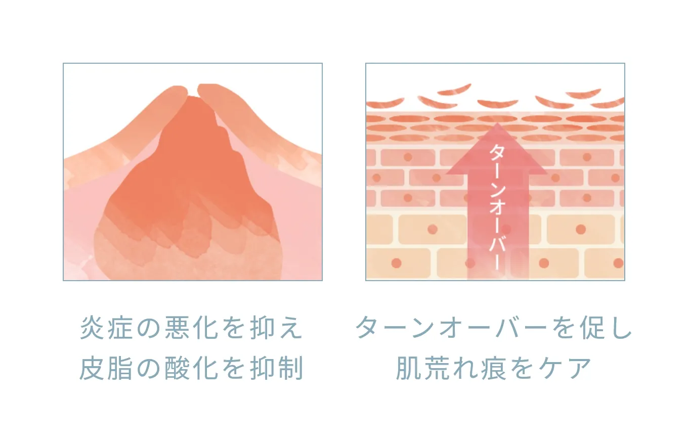 炎症 酸化 肌荒れ痕