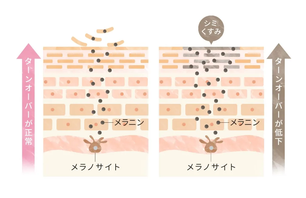 炎症 酸化 肌荒れ痕