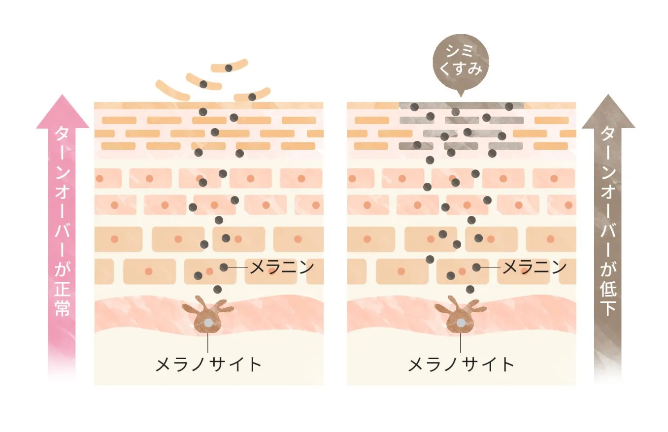 炎症 酸化 肌荒れ痕