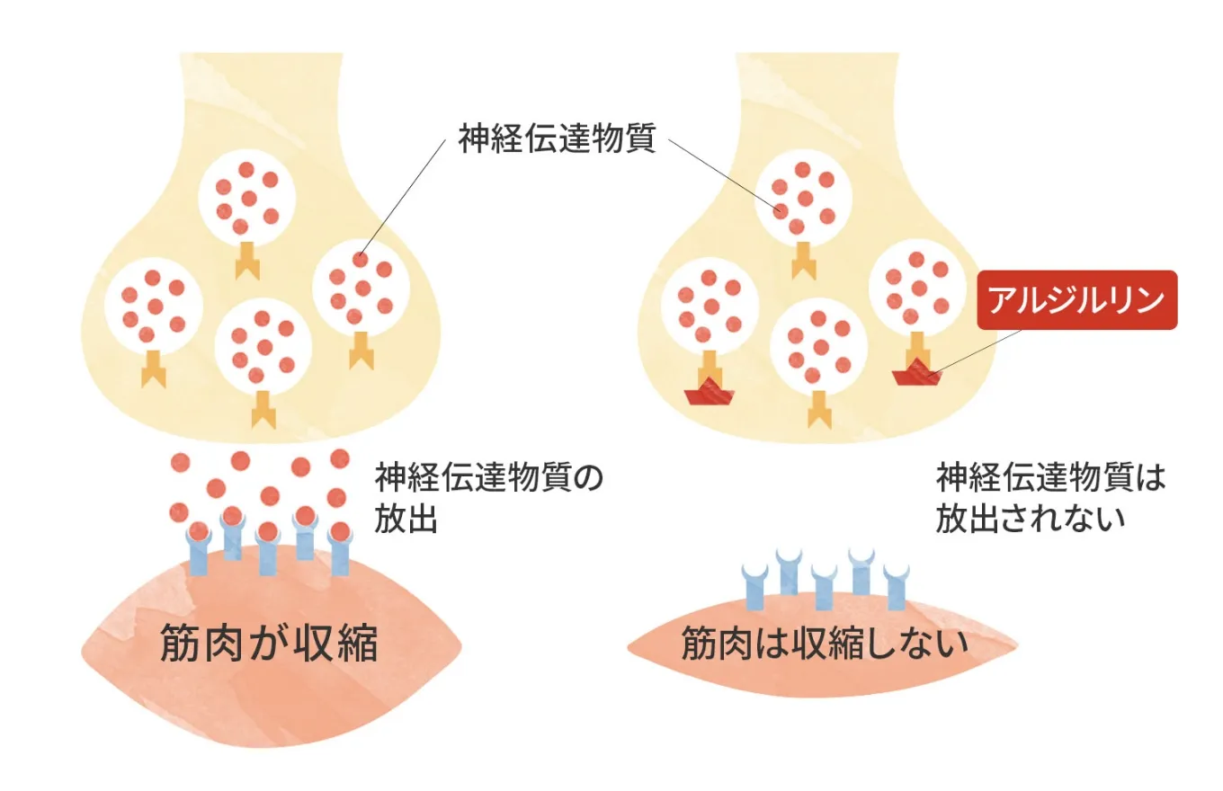 炎症 酸化 肌荒れ痕