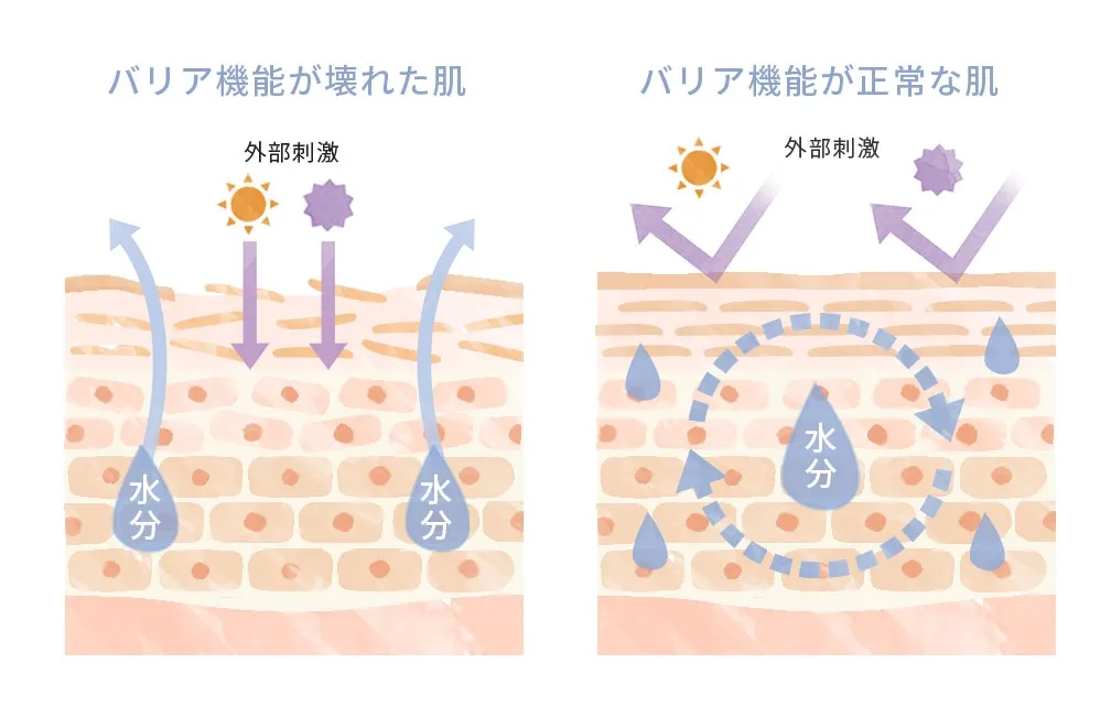 炎症 酸化 肌荒れ痕